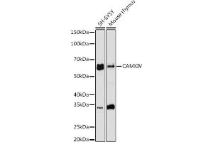 Western blot analysis of extracts of various cell lines, using CAMKIV antibody (ABIN7266021) at 1:1000 dilution. (CAMK4 Antikörper)