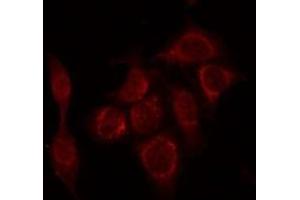 ABIN6266732 staining HepG2 by IF/ICC. (PTTG1 Antikörper  (Internal Region))