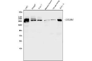 Western blot analysis of EIF2AK4 using anti-EIF2AK4 antibody (ABIN7600753).