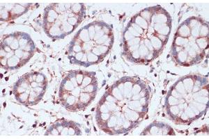 Immunohistochemistry of paraffin-embedded Human colon using S100A5 Polyclonal Antibody at dilution of 1:100 (40x lens). (S100A5 Antikörper)