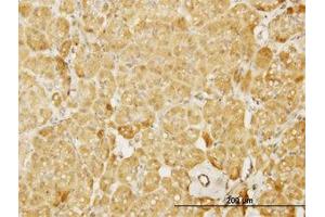 Image no. 2 for anti-Neural Wiskott-Aldrich syndrome protein (WASL) (AA 97-185) antibody (ABIN598590) (Neural Wiskott-Aldrich syndrome protein (WASL) (AA 97-185) Antikörper)