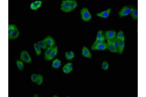 Immunofluorescence staining of HepG2 cells with ABIN7156777 at 1:133, counter-stained with DAPI. (IL12RB2 Antikörper  (AA 366-470))