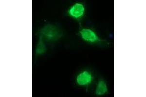 Image no. 3 for anti-CD163 (CD163) antibody (ABIN1497170) (CD163 Antikörper)