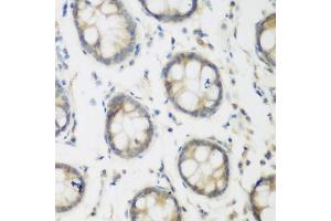 Immunohistochemistry of paraffin-embedded human colon using ACCS antibody (ABIN6293455) at dilution of 1:200 (40x lens). (PHACS Antikörper)