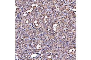 IHC analysis of Scavenging Receptor SRB2/SCARB2 using anti-Scavenging Receptor SRB2/SCARB2 antibody (ABIN7601833).