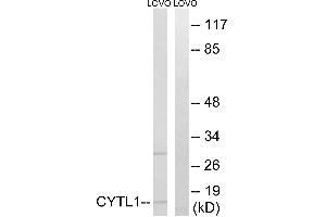 Immunohistochemistry analysis of paraffin-embedded human brain tissue using CYTL1 antibody. (CYTL1 Antikörper)