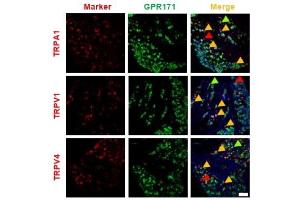 Double immunostaining of GPR171 expressions in Transient receptor potential (TRP)-expresser neurons and the effect on TRP-mediated nociceptions of GPR171 activation. (TRPA1 Antikörper  (AA 1050-1120))