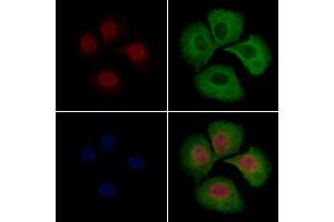 hFANCI Antibody staining Hela cells by IF/ICC. (FANCI Antikörper  (C-Term))