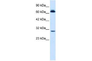 WB Suggested Anti-SIRT3 Antibody Titration:  0. (SIRT3 Antikörper  (C-Term))