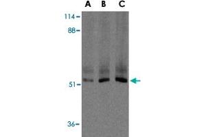 Western blot analysis of XIAP in human kidney lysate with XIAP polyclonal antibody  at 0.