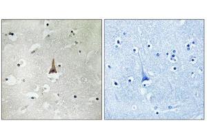Immunohistochemistry analysis of paraffin-embedded human brain tissue using LRP10 antibody. (LRP10 Antikörper  (Internal Region))