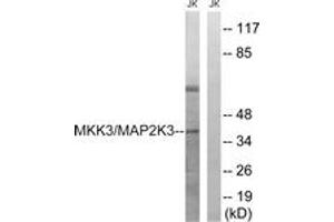Western blot analysis of extracts from Jurkat cells, treated with serum 20% 15', using MAP2K3 (Ab-222) Antibody. (MAP2K3 Antikörper  (AA 188-237))