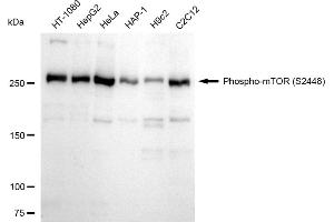 Western blotting analysis using Phospho-mTOR (S(ABIN7800001) antibody (ABIN7799348). (Rekombinanter MTOR Antikörper  (pSer2448))