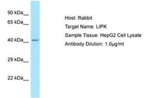 Image no. 1 for anti-Lipase, Family Member K (LIPK) (N-Term) antibody (ABIN6750053)