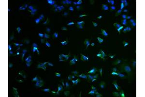 Immunofluorescence staining of MCF-7 cells with ABIN7167574 at 1:100, counter-stained with DAPI. (RIMS4 Antikörper  (AA 1-269))