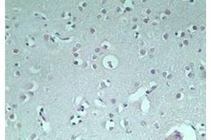 Image no. 1 for anti-Ring Finger Protein 128 (RNF128) (AA 227-253) antibody (ABIN207733) (RNF128 Antikörper  (AA 227-253))