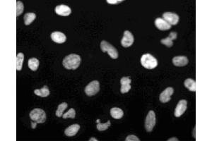Immunofluorescent staining of U-2 OS (ATCC HTB-96) cells. (PARP1 Antikörper)