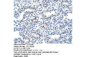 Rabbit Anti-PAIP1 Antibody  Paraffin Embedded Tissue: Human Lung Cellular Data: Alveolar cells Antibody Concentration: 4.