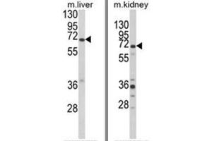 (LEFT) Western blot analysis of EHHADH Antibody (C-term) in mouse liver tissue lysates (35ug/lane). (EHHADH Antikörper  (C-Term))