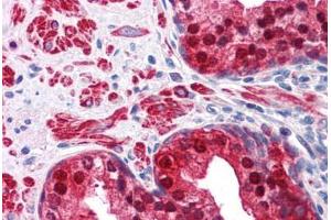 Human Prostate: Formalin-Fixed, Paraffin-Embedded (FFPE) (IDH1 Antikörper  (AA 30-307))