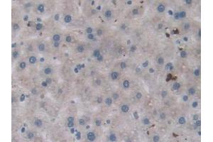 Detection of PTPRB in Rat Liver Tissue using Polyclonal Antibody to Protein Tyrosine Phosphatase Receptor Type B (PTPRB)