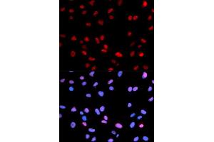 Immunofluorescence analysis of U2OS cell using Phospho-RB-S795 antibody. (Retinoblastoma 1 Antikörper  (pSer795))