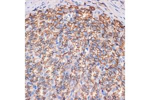 Immunohistochemistry of paraffin-embedded rat stomach using CTNN Rabbit mAb (ABIN7266135) at dilution of 1:100 (40x lens). (CTNNA3 Antikörper)