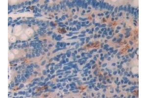 Detection of LCNL1 in Rat Small intestine Tissue using Polyclonal Antibody to Lipocalin Like Protein 1 (LCNL1) (LCNL1 Antikörper)