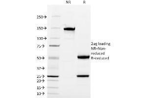 SDS-PAGE Analysis Purified CD13 Mouse Monoclonal Antibody (WM15). (CD13 Antikörper)
