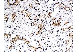 Formalin-fixed and paraffin embedded rat renal tubular endothelial cells labeled with Anti-EAAT3, Unconjugated (ABIN733943) followed by conjugation to the secondary antibody and DAB staining (SLC1A1 Antikörper  (AA 451-524))