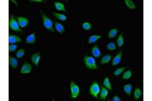 Immunofluorescent analysis of A549 cells using ABIN7175150 at dilution of 1:100 and Alexa Fluor 488-congugated AffiniPure Goat Anti-Rabbit IgG(H+L) (USHBP1 Antikörper  (AA 1-260))