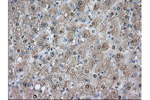 Immunohistochemical staining of paraffin-embedded prostate tissue using anti-PDE4A mouse monoclonal antibody. (PDE4A Antikörper)