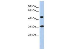 Image no. 1 for anti-Chromosome 22 Open Reading Frame 25 (C22orf25) (N-Term) antibody (ABIN6743715) (C22orf25 Antikörper  (N-Term))