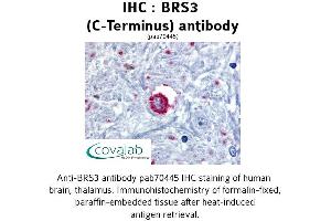 Image no. 1 for anti-Bombesin-Like Receptor 3 (BRS3) (C-Term), (Cytoplasmic Domain) antibody (ABIN1732418) (BRS3 Antikörper  (C-Term, Cytoplasmic Domain))