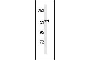 SGSM1 Antibody (Center) (ABIN1881801 and ABIN2843255) western blot analysis in MDA-M cell line lysates (35 μg/lane). (SGSM1 Antikörper  (AA 624-652))