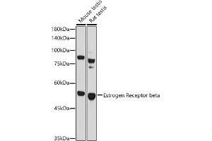 Western blot analysis of extracts of various cell lines, using Estrogen Receptor beta antibody (ABIN3016231, ABIN3016232, ABIN3016233 and ABIN6219642) at 1:1000 dilution. (ESR2 Antikörper  (AA 1-280))