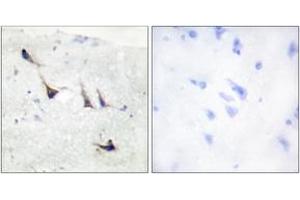 Immunohistochemistry analysis of paraffin-embedded human brain tissue, using Syntaxin 1A (Ab-14) Antibody. (STX1A Antikörper  (AA 1-50))