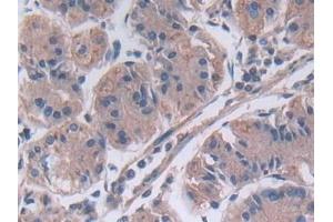 Immunohistochemistry (IHC) image for anti-Matrix Metallopeptidase 23B (MMP23B) (AA 79-390) antibody (ABIN7431308)