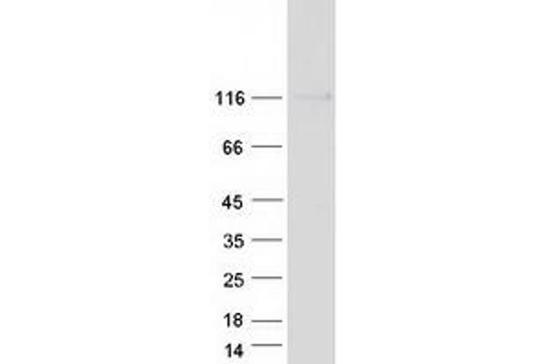 Integrin Alpha2b Protein (CD41) (Myc-DYKDDDDK Tag)