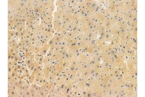 ABIN6265555 and ABIN6266853 at 1/100 staining human normal liver tissue by IHC-P. (Transglutaminase 2 Antikörper  (N-Term))