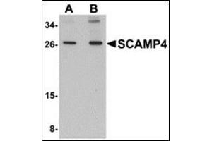 Western blot analysis of SCAMP4 in 3T3 cell lysate with this product at (A) 1 and (B) 2 μg/ml. (SCAMP4 Antikörper  (C-Term))