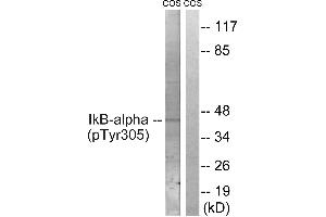 Immunohistochemistry analysis of paraffin-embedded human lymph node tissue using IκB-α (Phospho-Tyr305) antibody. (NFKBIA Antikörper  (pTyr305))