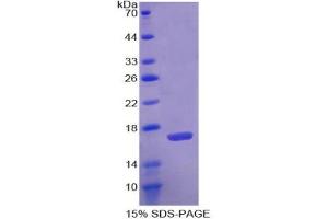 SDS-PAGE analysis of Human Agmatine Ureohydrolase Protein. (AGMAT Protein)