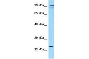 Image no. 1 for anti-Killer Cell Lectin-Like Receptor Subfamily K, Member 1 (KLRK1) (AA 121-170) antibody (ABIN6748394) (KLRK1 Antikörper  (AA 121-170))