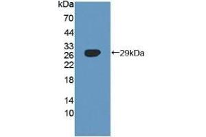 Detection of Recombinant SNX13, Human using Polyclonal Antibody to Sorting Nexin 13 (SNX13) (SNX13 Antikörper  (AA 97-284))