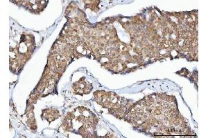 IHC analysis of MFF using anti-MFF antibody (ABIN7599292).