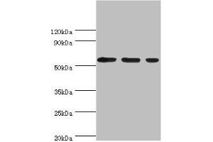 Western blot All lanes: Aladin antibody at 5 μg/mL Lane 1: Hela whole cell lysate Lane 2: Mouse brain tissue Lane 3: NIH/3T3 whole cell lysate Secondary Goat polyclonal to rabbit IgG at 1/10000 dilution Predicted band size: 60, 56 kDa Observed band size: 60 kDa