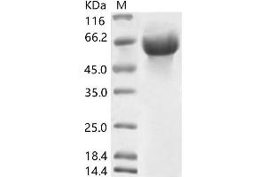 Western Blotting (WB) image for Coronavirus OC43 Hemagglutinin Esterase (HCoV-OC43 HE) protein (His tag) (ABIN7198833)