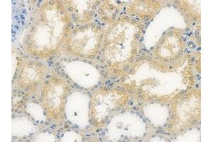ABIN7096416 and ABIN7100480 at 1/100 staining human normal kidney tissue by IHC-P. (FBXL2 Antikörper)