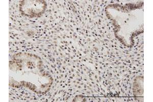 Immunoperoxidase of purified MaxPab antibody to RSC1A1 on formalin-fixed paraffin-embedded human endometrium.
